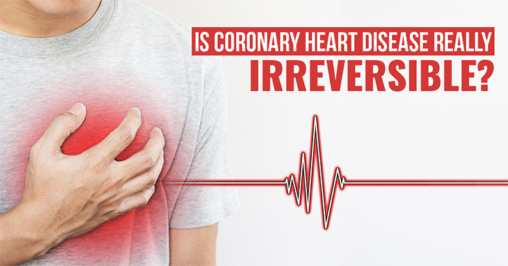 Coronary Heart Disease